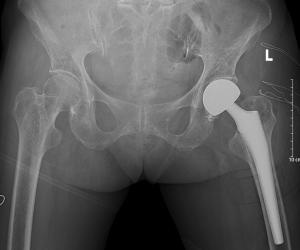 ϽҽԺһƳɹΪ93ʵʩɹͷû