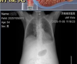 ϽҽԺڿŶӣƾԸӲˮƽȻָ