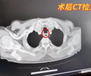 ӡˮѽʳ ϽҽԺƹʳ˫Σ