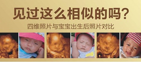 四维彩超医院